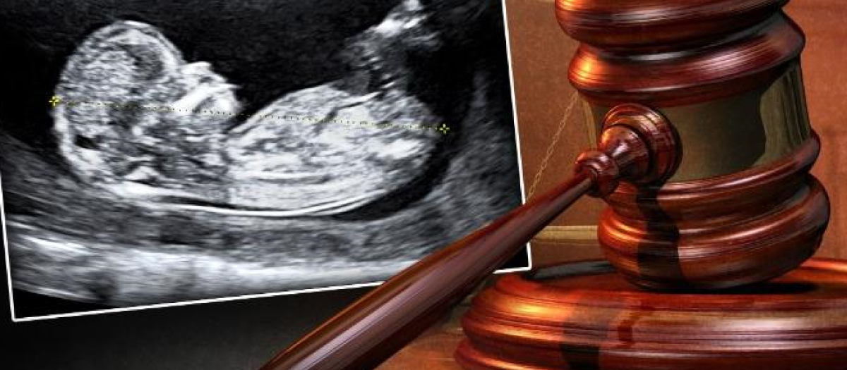 Representación simbólica del sometimiento judicial de la ley provida