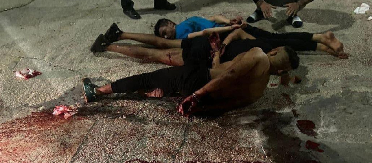 El resultado de una de las violentas peleas callejeras en Cocentaina