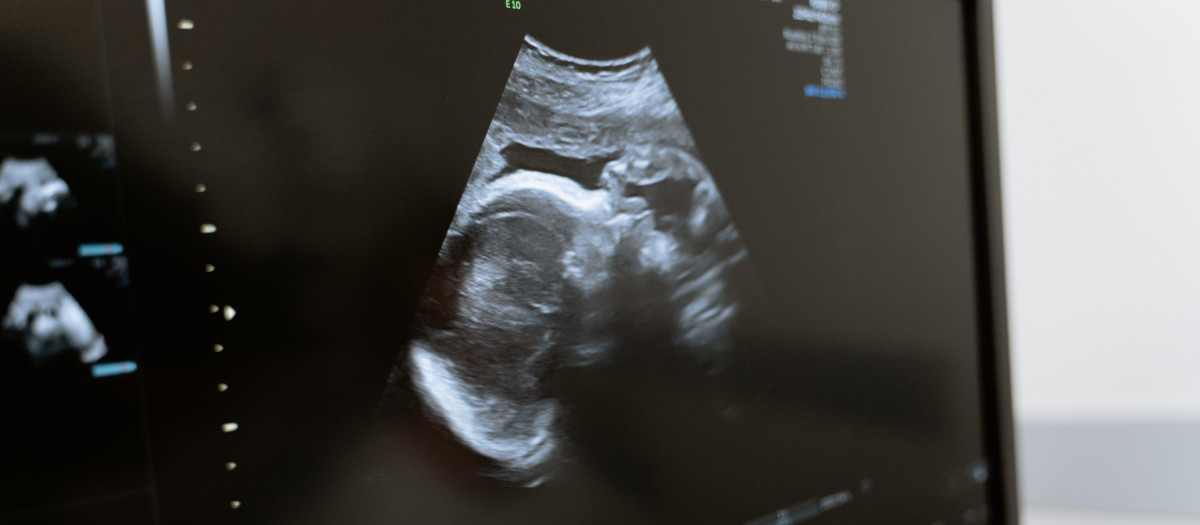 La terapia fetal requiere, en primer lugar, afinar en la detección de enfermedades congénitas