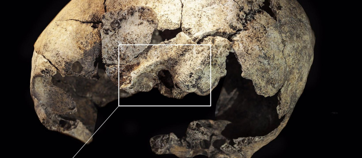 Cráneo de la mujer investigada por el equipo de la UVA