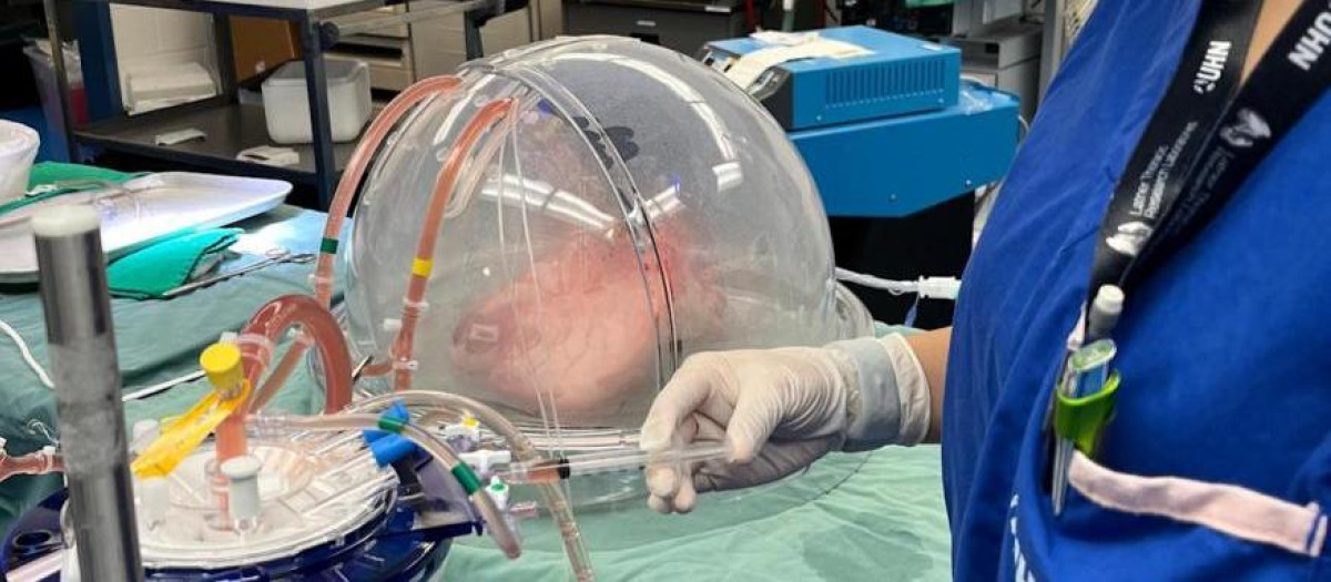 Los órganos elaborados son de tipo 0 debido a la compatibilidad universal de ese tipo de sangre