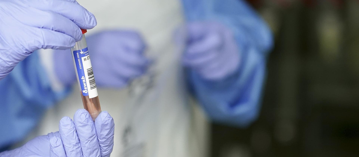 Análisis de una prueba PCR