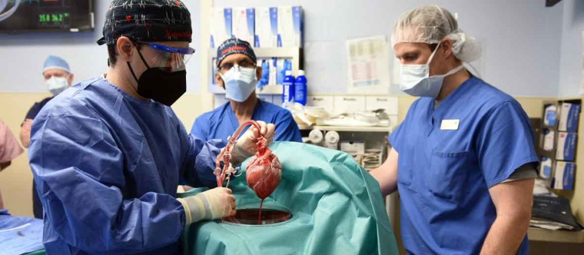 Corazón de cerdo utilizado en el trasplante