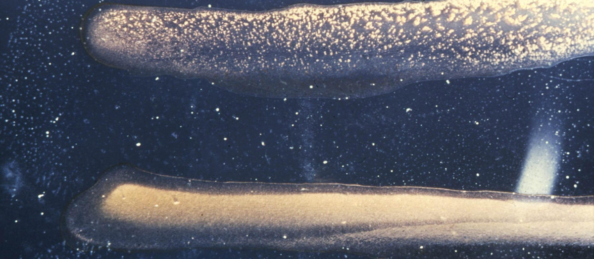 Imagen de microscopio de Vibrio cholerae, bacteria causante del cólera
