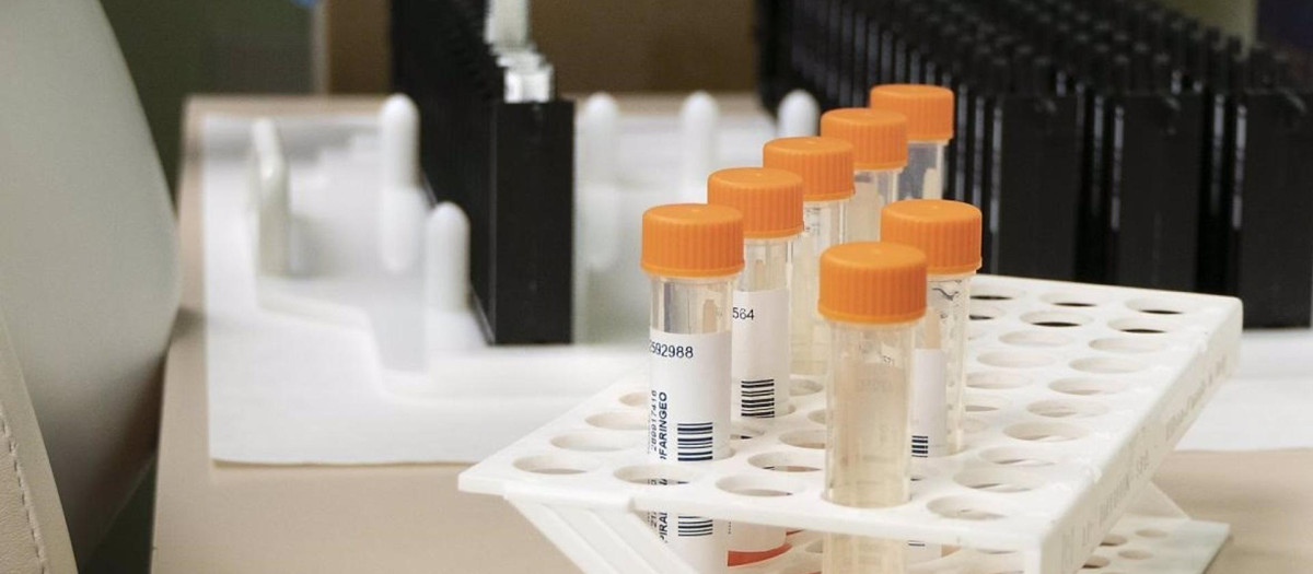 Muestras de viruela del mono