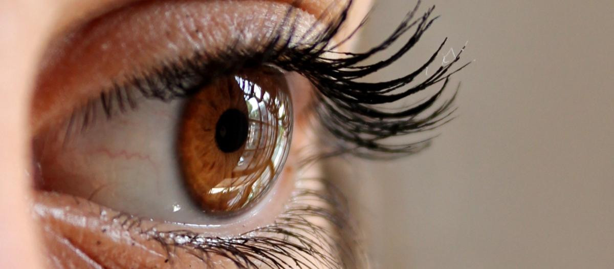 Con el derrame ocular, el ojo cobra un color rojizo y brillante