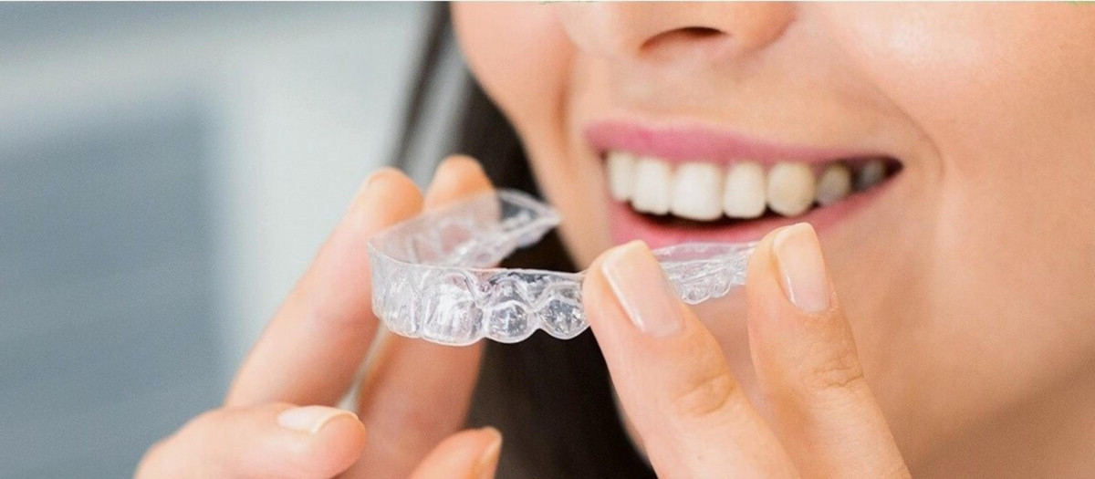 Ortodoncia invisibles