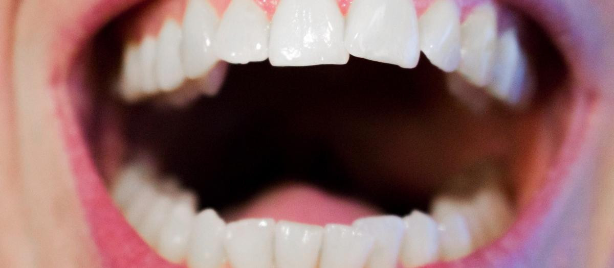 Los dientes no son blancos, su color se acerca más al del marfil