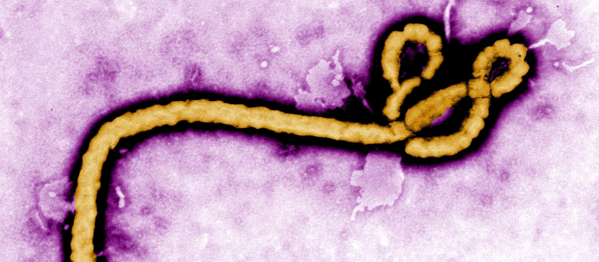Virus del ébola
