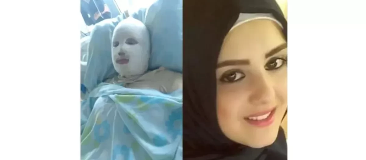 Hana Mohammed Khodor se debatió entre la vida y la muerte durante 11 largos días tras recibir la brutal paliza