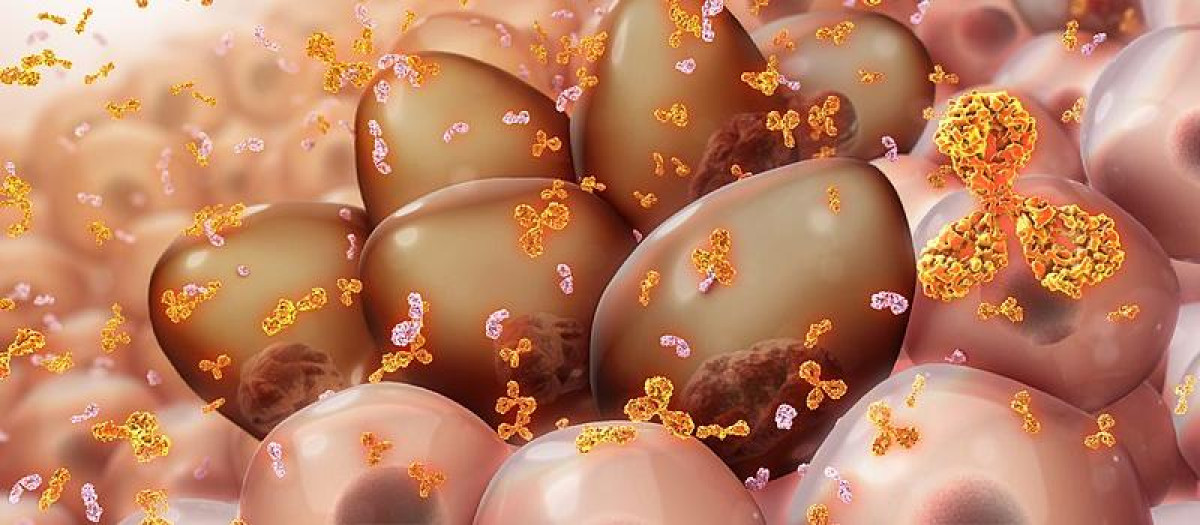 Las células de mieloma que producen proteínas monoclonales de diversos tipos