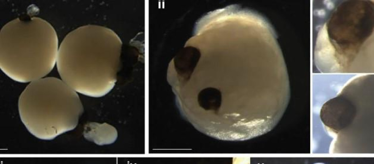 Organoides cerebrales con copas ópticas al día 60 de desarrollo