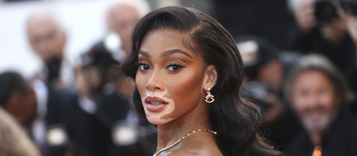 La modelo Winnie Harlow