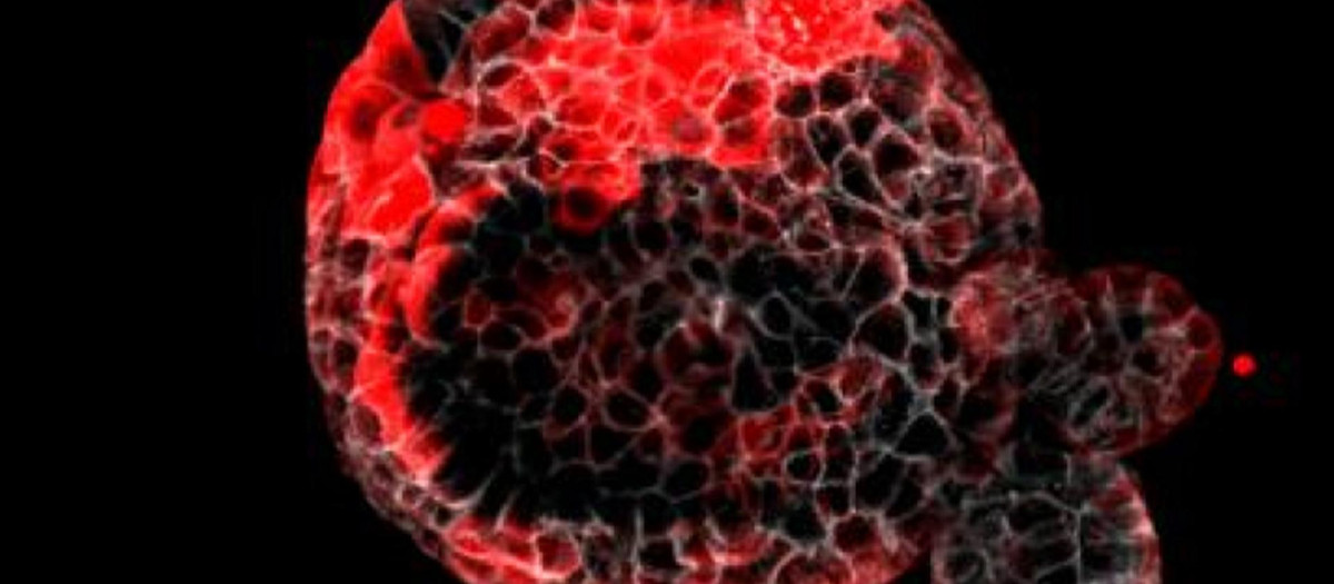 Organoide de cáncer colorrectal con las células residuales responsables de la recaída en rojo.