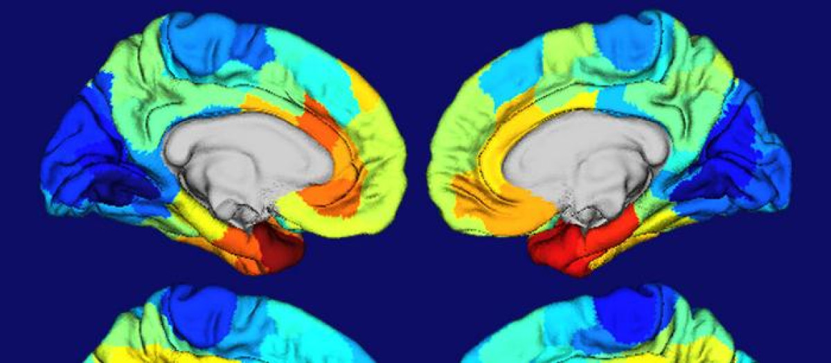 Las áreas rojas y naranjas en estos mapas de calor de cerebros humanos muestran dónde el gen APOE está más activo