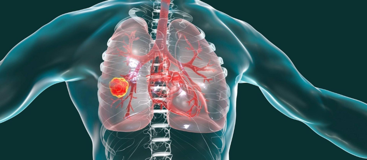 Los investigadores llevan años estudiando la eficacia de la detección del cáncer