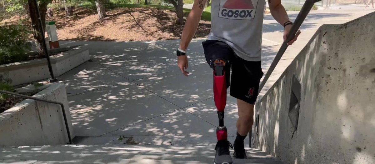 Persona amputada usando la prótesis robótica de la Universidad de Utah