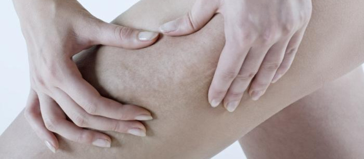Radiofrecuencia para redefinir cuerpo y rostro