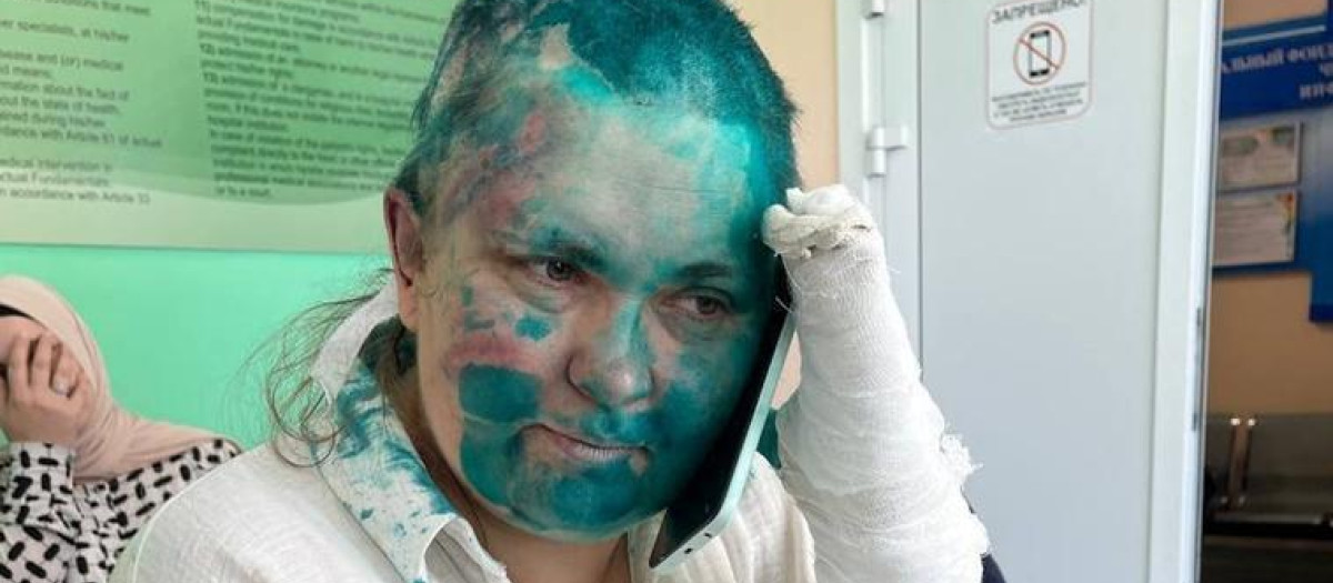 Elena Miláshina tras ser atendida en el hospital