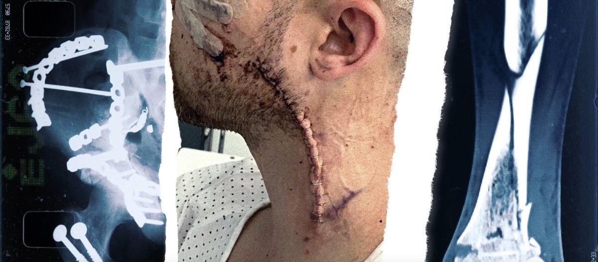 Consecuencias de agresiones a policías, en una imagen de la campaña 'Tiene delito', de la CEP