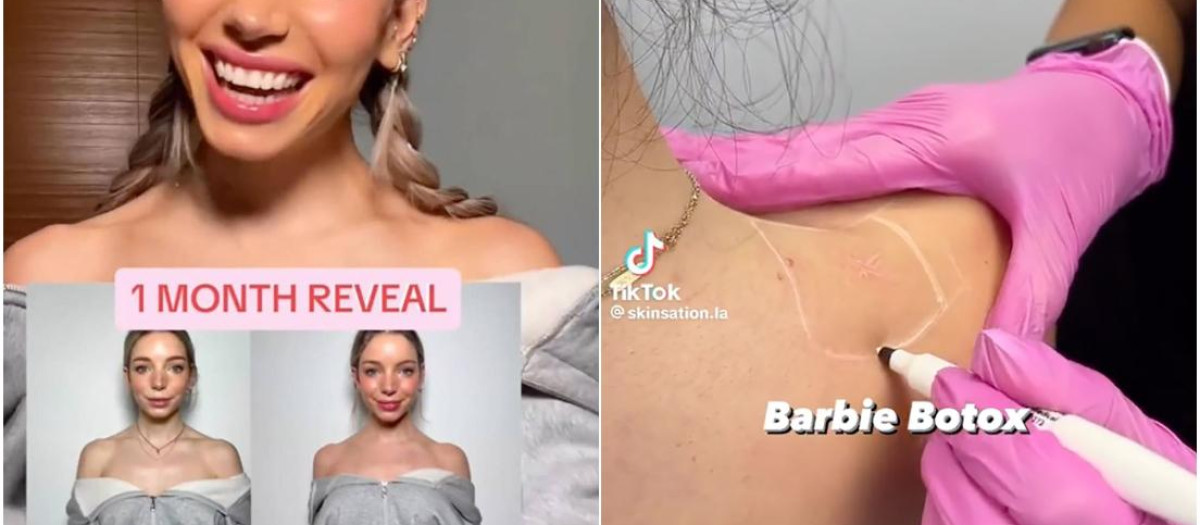 Isabelle Lux, la mujer que asegura haber popularizado el 'Barbie Bótox'