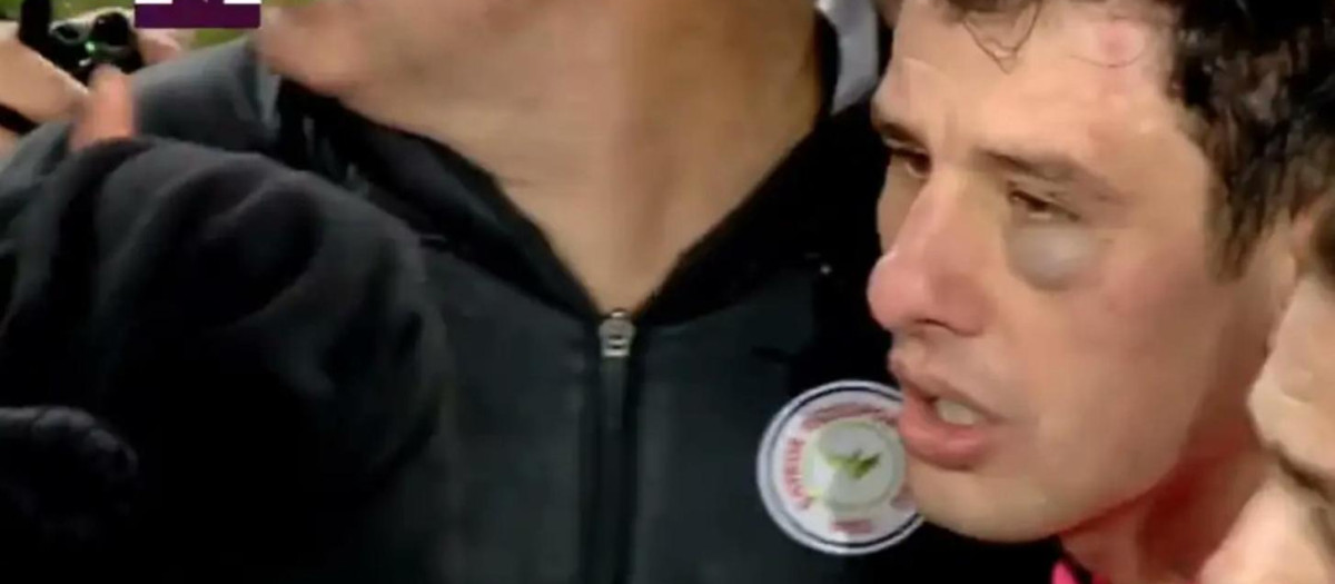 El árbitro fue agredido en un partido en Turquia