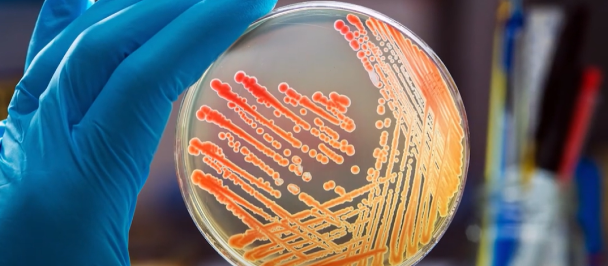 Bacterias