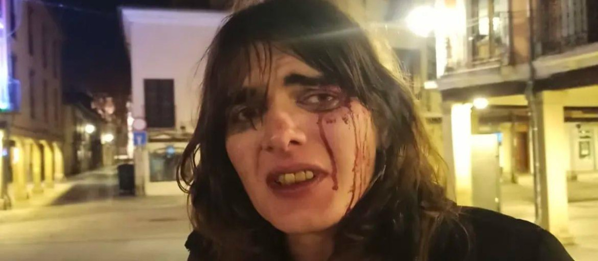 La mujer trans son sangre en la cara tras la agresión