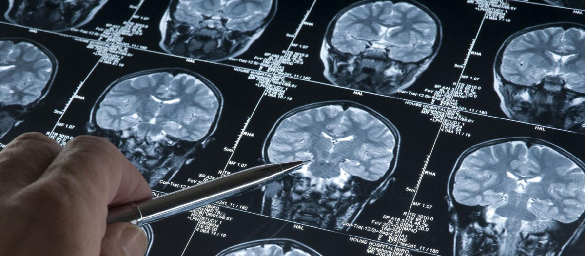 El CSIC consigue diseñar una molécula a través de IA, para tratar el alzhéimer y el cáncer