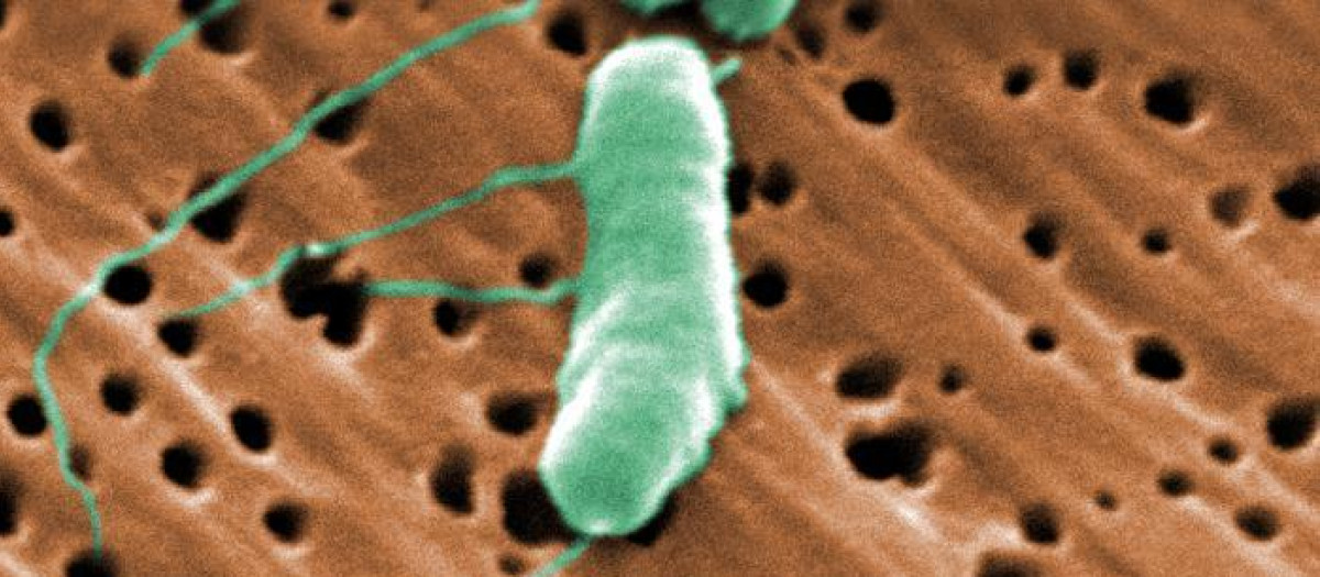 Vibrio vulnificus