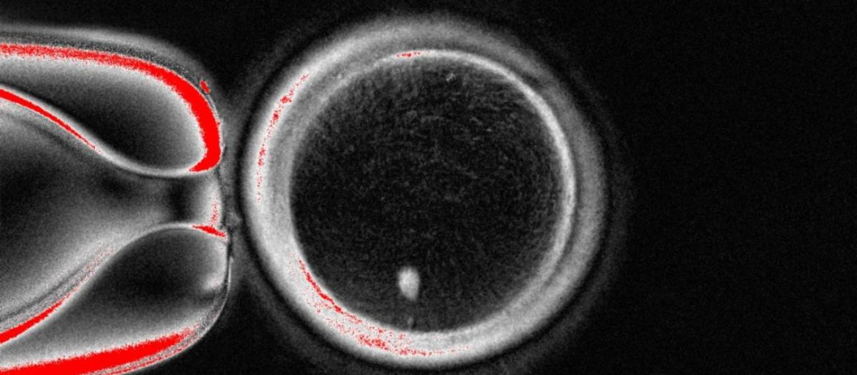Ovocito con una imagen brillante del núcleo de una célula cutánea antes de la fecundación