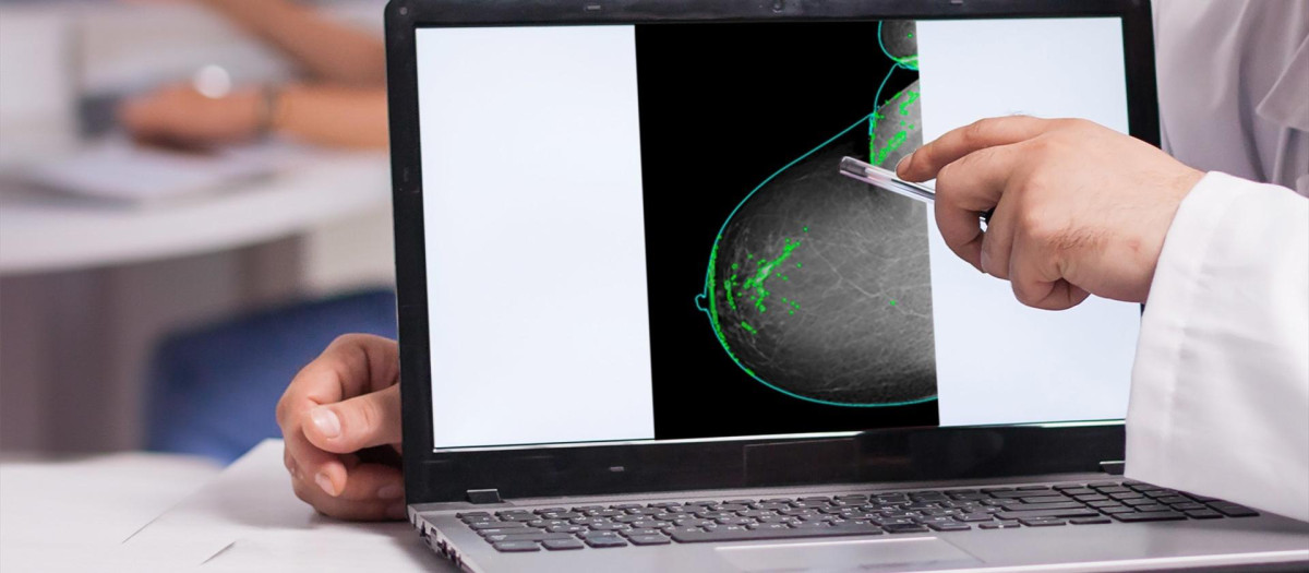 Imagen de archivo de un análisis de cáncer de mama