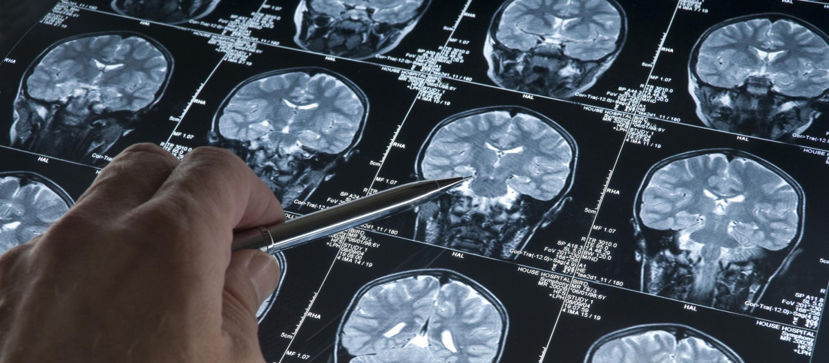 Tomografía cerebral de la cabeza y cerebro