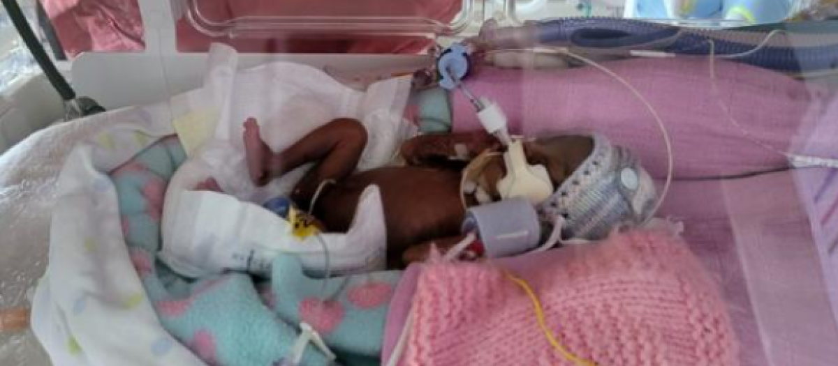 Desire con 22 semanas