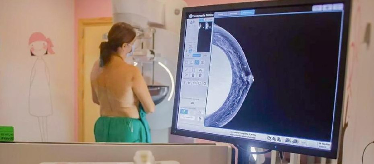 Realización de una mamografía a una mujer (archivo)