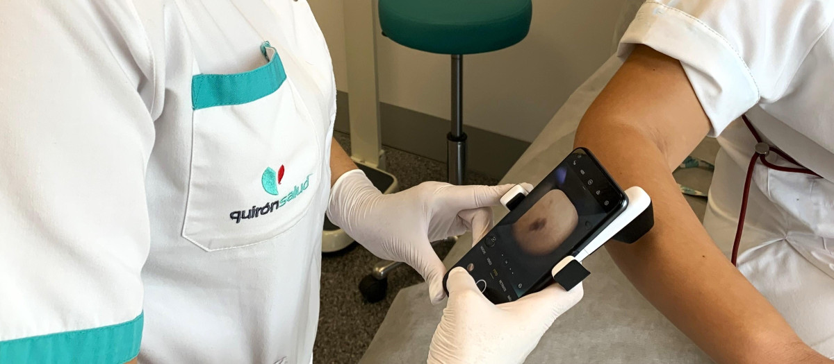Toma de imagen de una lesión de la piel con un dermatoscopio