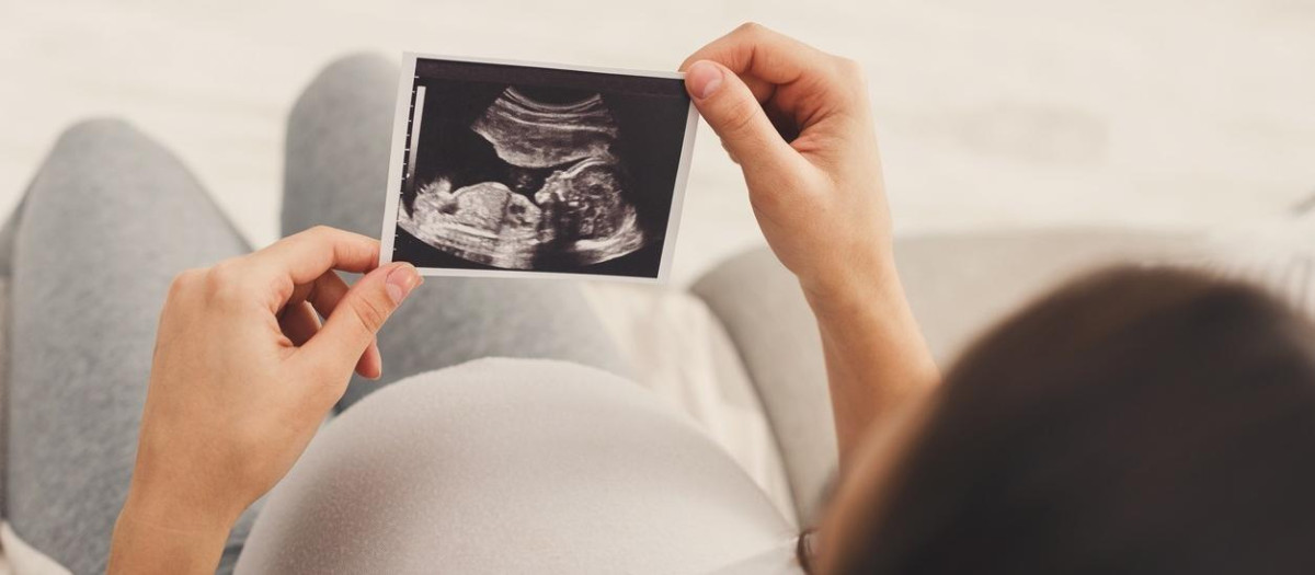 Una mujer embarazada mira la ecografía de su bebé