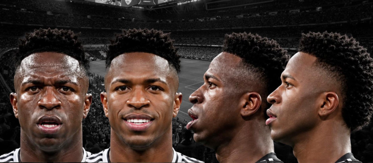 El antes y después del rostro de Vinicius Jr. tras pasar por el quirófano