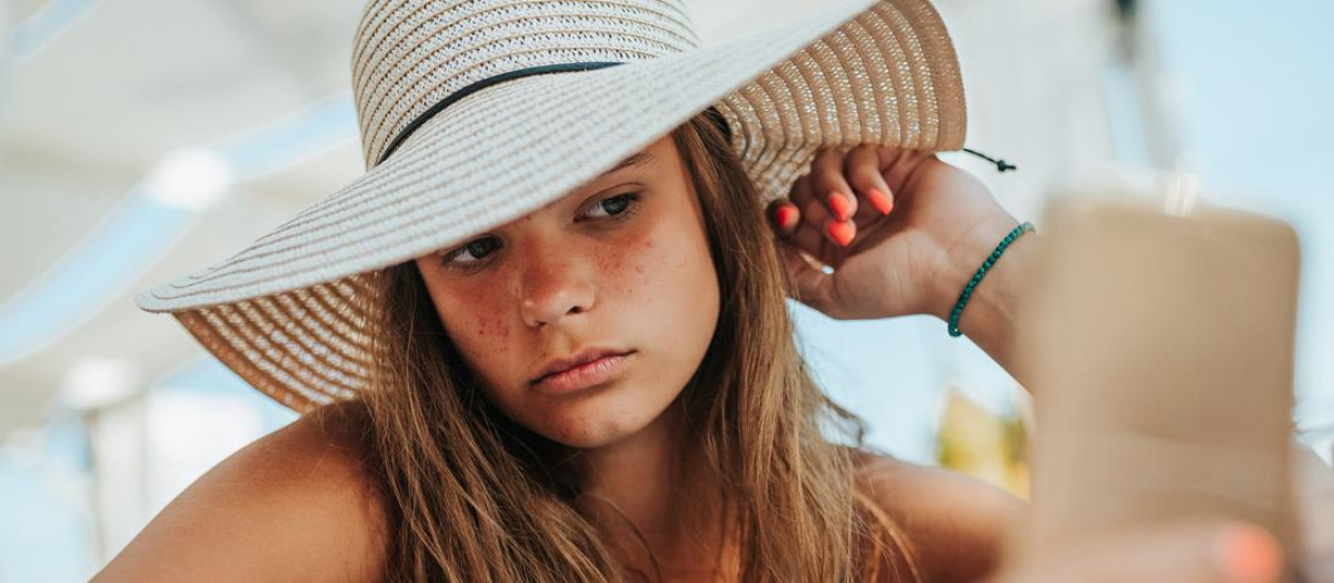 El acné en verano