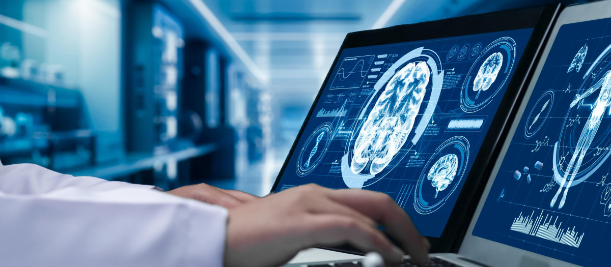 La resonancia magnética puede ayudar a predecir la progresión de la enfermedad de Alzheimer