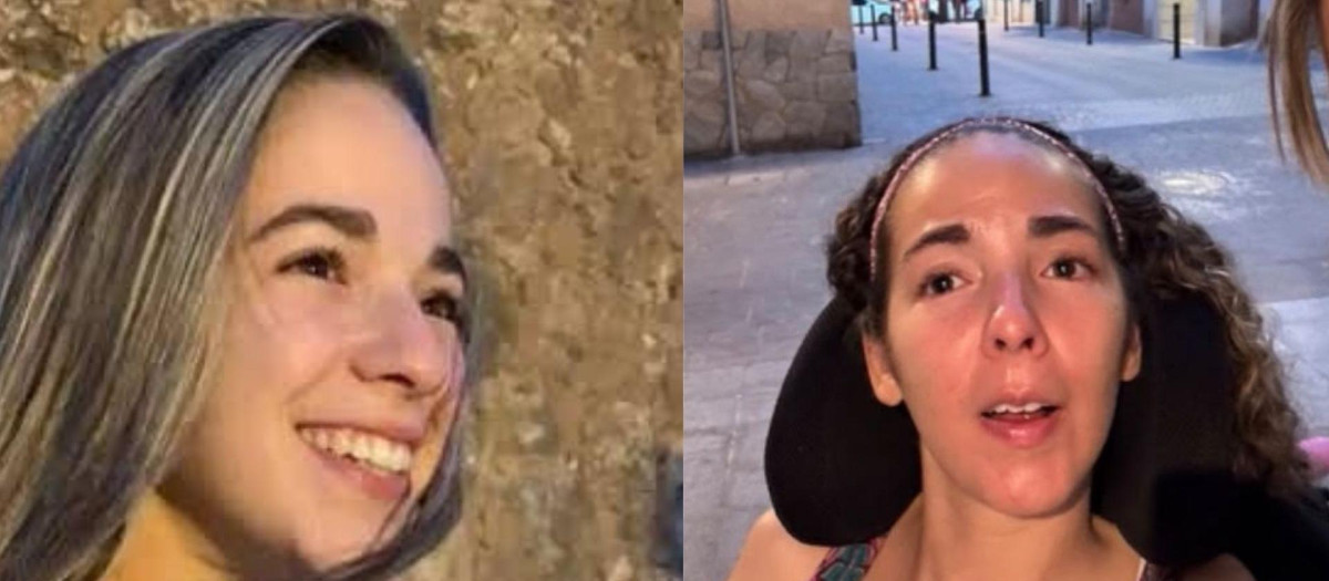 A la izquierda una imagen de Marta antes del shock, y a la derecha en su estado actual