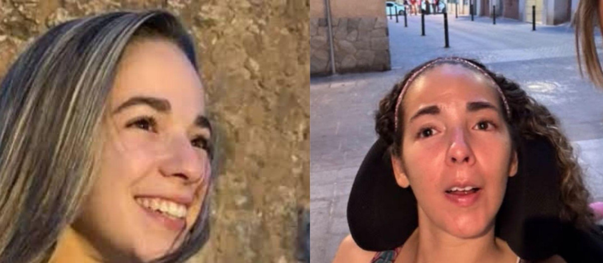 A la izquierda una imagen de Marta antes del shock, y a la derecha en su estado actual