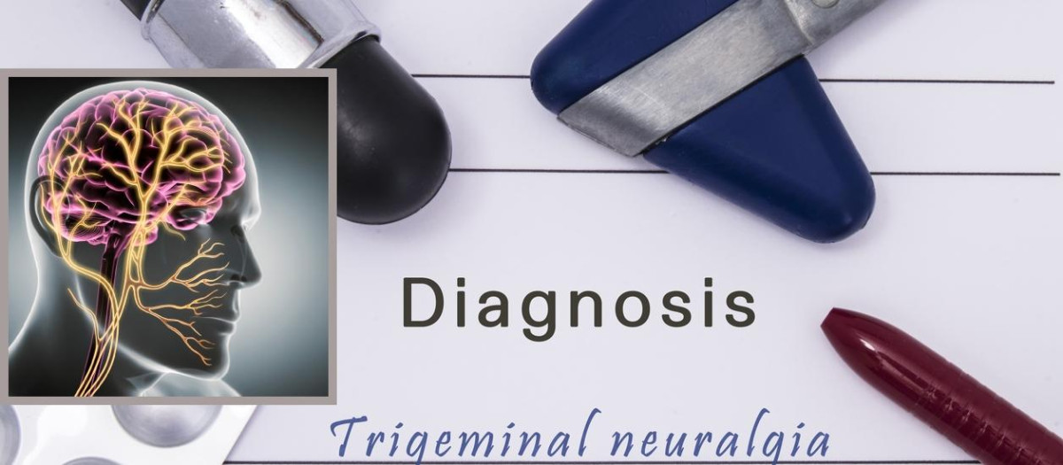 Neuralgia de trigémino