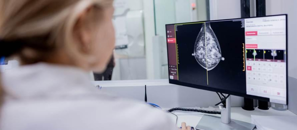 Ensayos prospectivos permitirán comprobar si la cabergolina puede prevenir el cáncer de mama