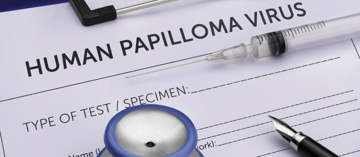 Virus del papiloma