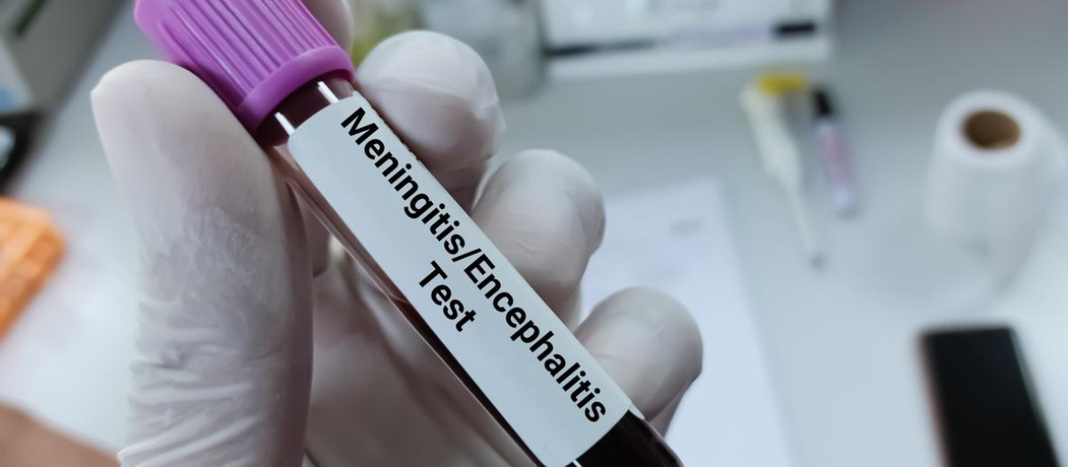 bioquímico sostiene una muestra de sangre para la prueba de PCR de meningitis o encefalitis
