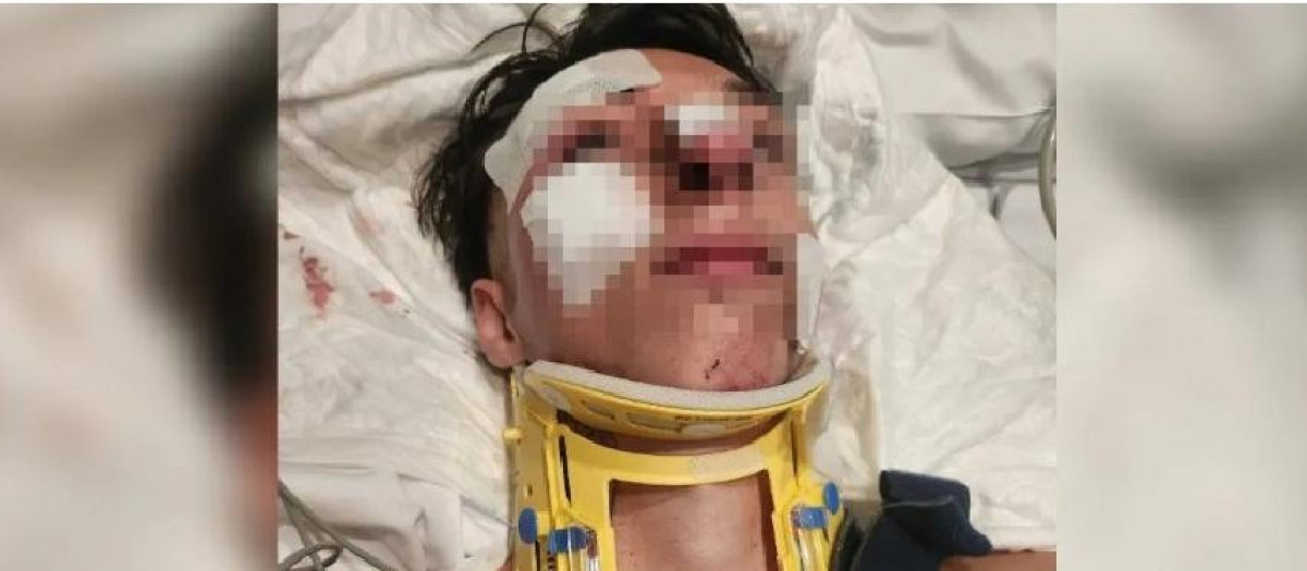 El joven, hospitalizado con heridas graves