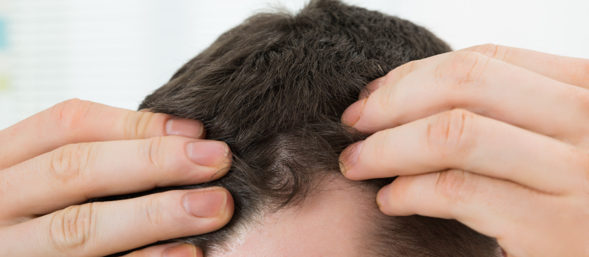 MAN CHECKING HAIRLINE AT HOME.LOSE,LOSING,LOOSING,LOSS,TEST,CHECKING,TESTING,SAMPLE,HAIR,HEAD,CARE,HUMANS,HUMAN BEINGS,PEOPLE,FOLK,PERSONS,HUMAN,HUMAN BEING,LOSE,LOSING,LOOSING,MEN,MAN,HAND,CLOSEUP,MALE,MASCULINE,SKIN,PERSON,LOSS,WELLBEING,LOOK,GLANCING,SEE,VIEW,LOOKING,PEEKING,LOOKING AT,SMALL,TINY,LITTLE,SHORT,ADULT,ONE,COMPANY,CONCERN,CORPORATION,MORNING,HIGH,TEST,CHECKING,TESTING,SAMPLE,PROBLEM,ADULTS,TOP,HAIRLINE,BALDNESS,TALL,HAIR,HEAD,TOMORROW,ANGLE,CARE,HOME,DANDRUFF,HAIRLOSS,DANDRUFF,HAIRLOSS,EXAMINING,SCRUTINY,TOUCHING,30S,INDOORS,ALOPECIA,RECEDING,MID,TRICHOLOGY