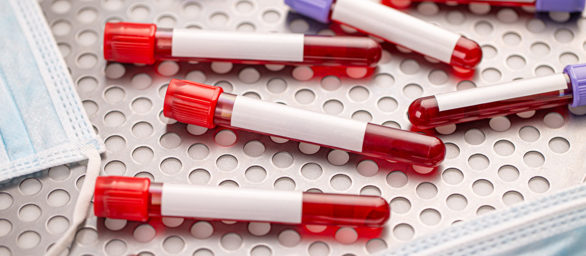 Buscan desarrollar glóbulos rojos