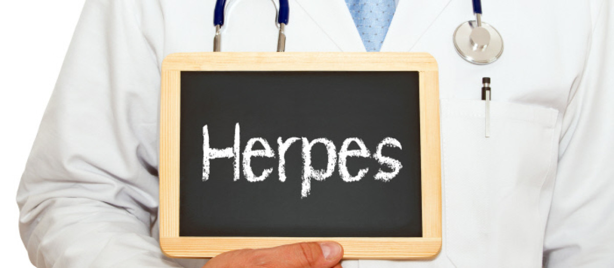 Herpes